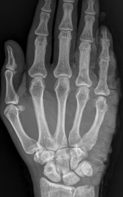 5 Drinks That May Affect Bone Health, According to Experts