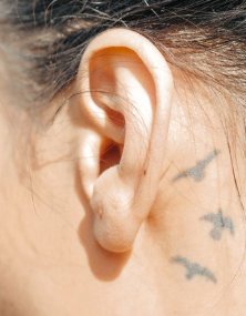 What Your Ears Can Reveal About Your Health