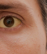 8 Signs of Vitamin B12 Deficiency You Shouldn’t Ignore