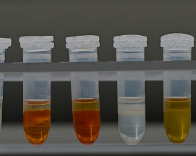 What Does the Color of Your Urine Say About Your Health?