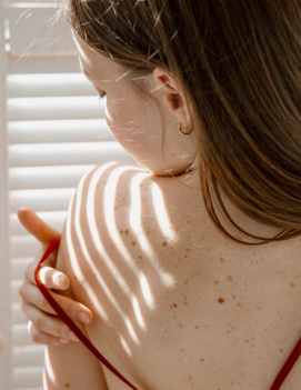The Truth About Red Spots on Your Skin: Common Causes Explained