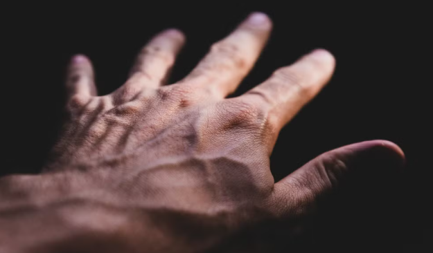 If Your Veins Are Visible, Here’s What It Could Mean