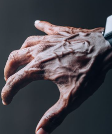 What Visible Veins Can Mean: Common Causes Explained